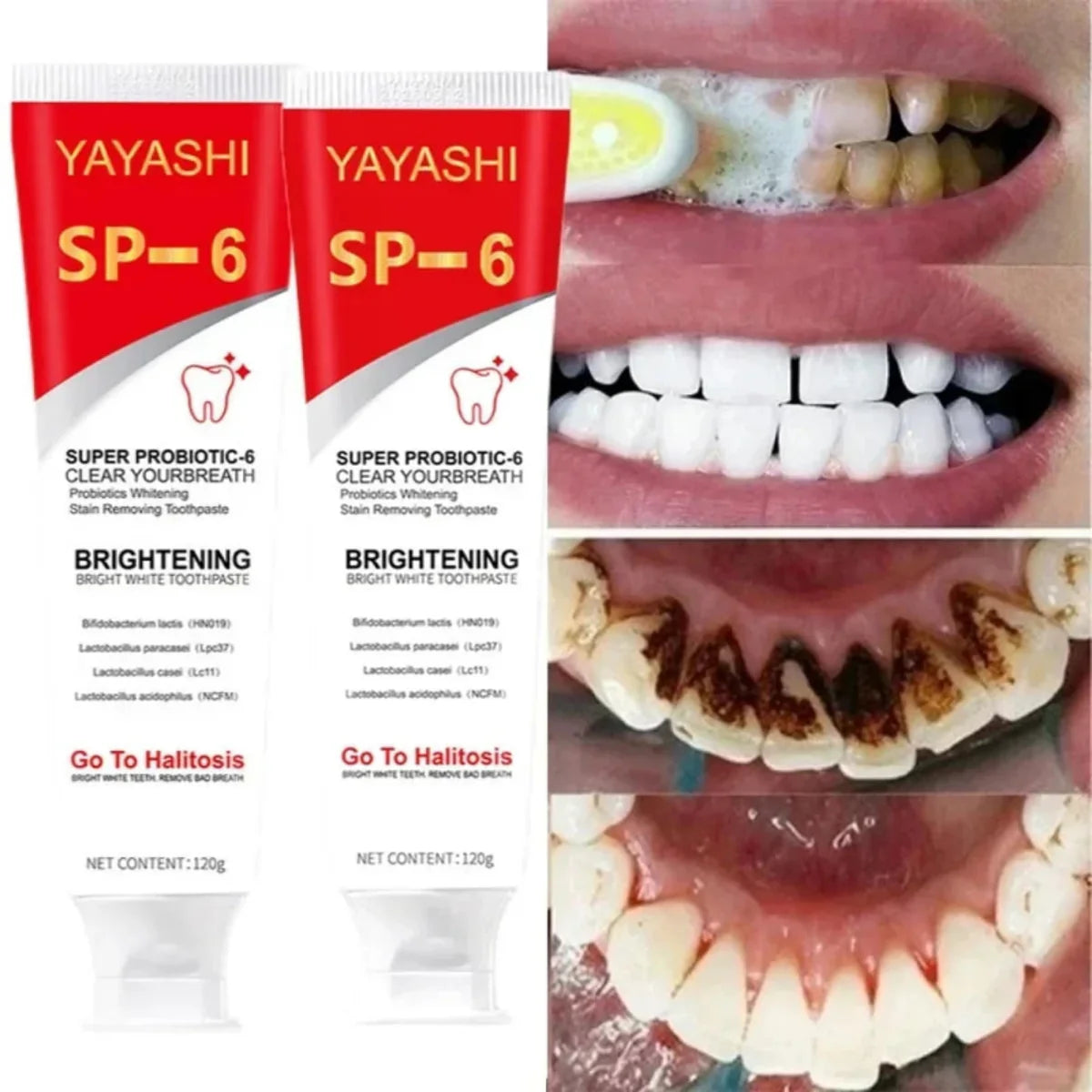 SP-6 Ultra Whitening Toothpaste (Original)