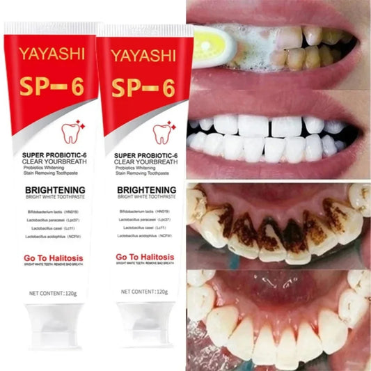 SP-6 Ultra Whitening Toothpaste (Original)